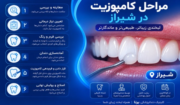 بهترین دکتر کامپوزیت دندان در شیراز